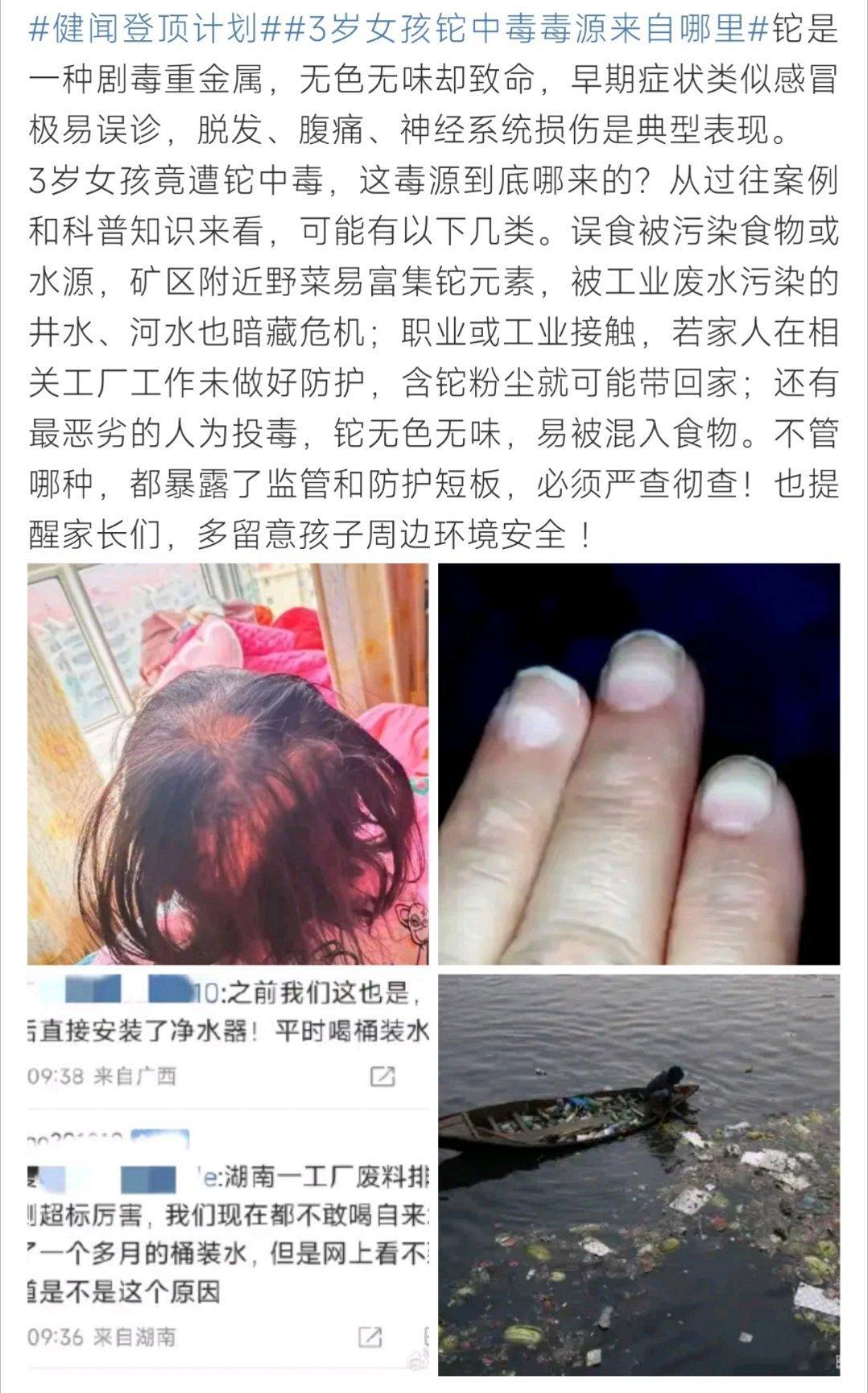 3岁女孩铊中毒毒源来自哪里3岁女孩铊中毒毒源来自哪里呀！你会去了解一下嘛 ​​​