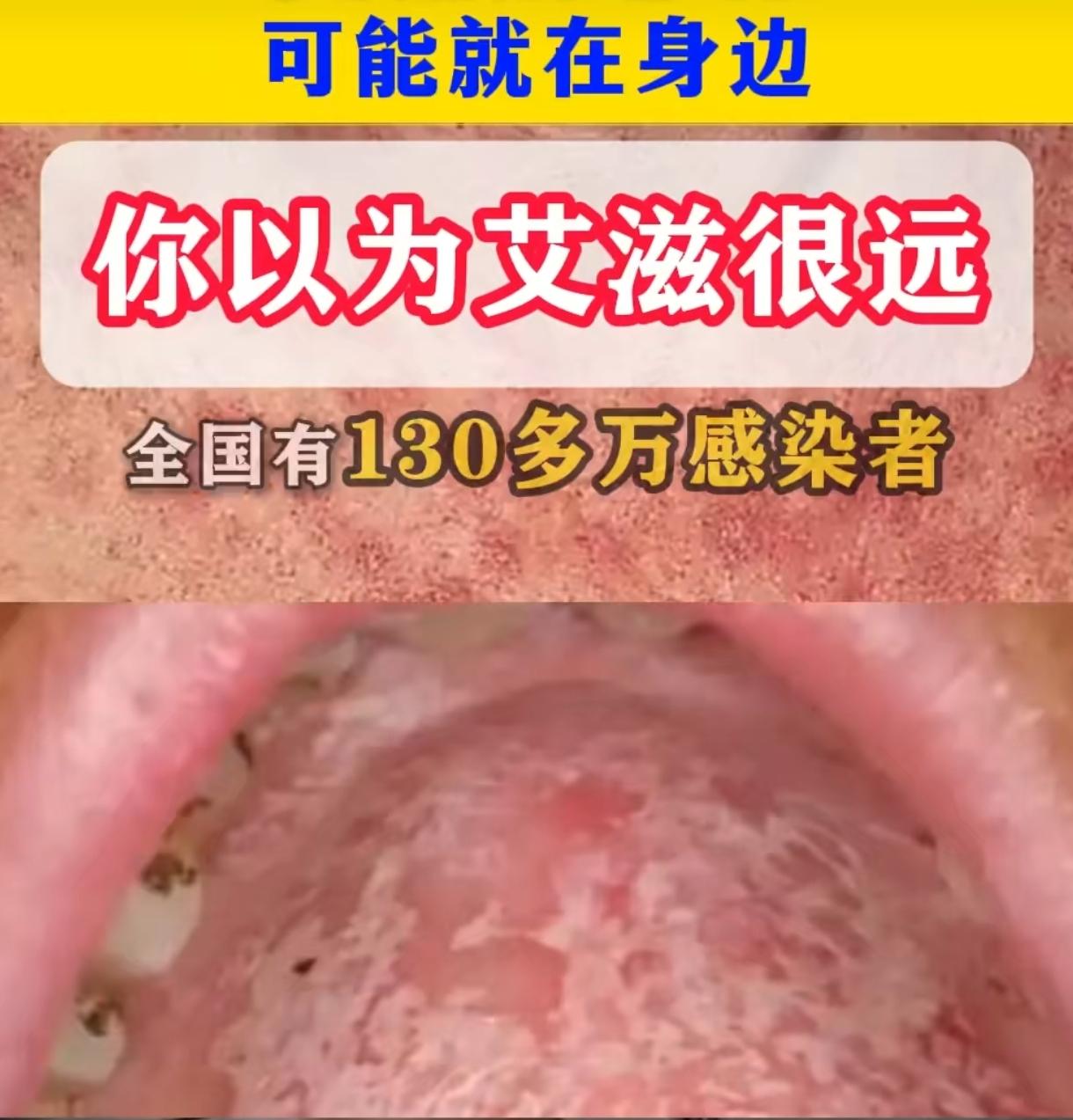 30年前手术输血染艾滋！女子索赔15万，法院终审判决来了
 
咱说这跨越30年的