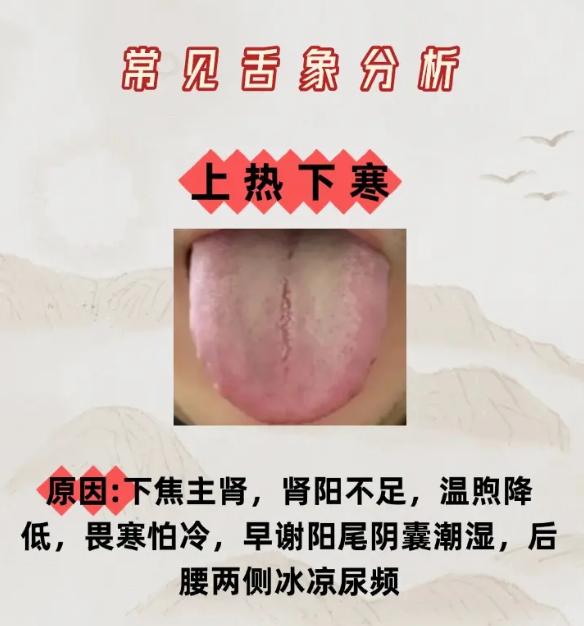 中医舌诊：上热下寒与脾阳虚的辨证要点