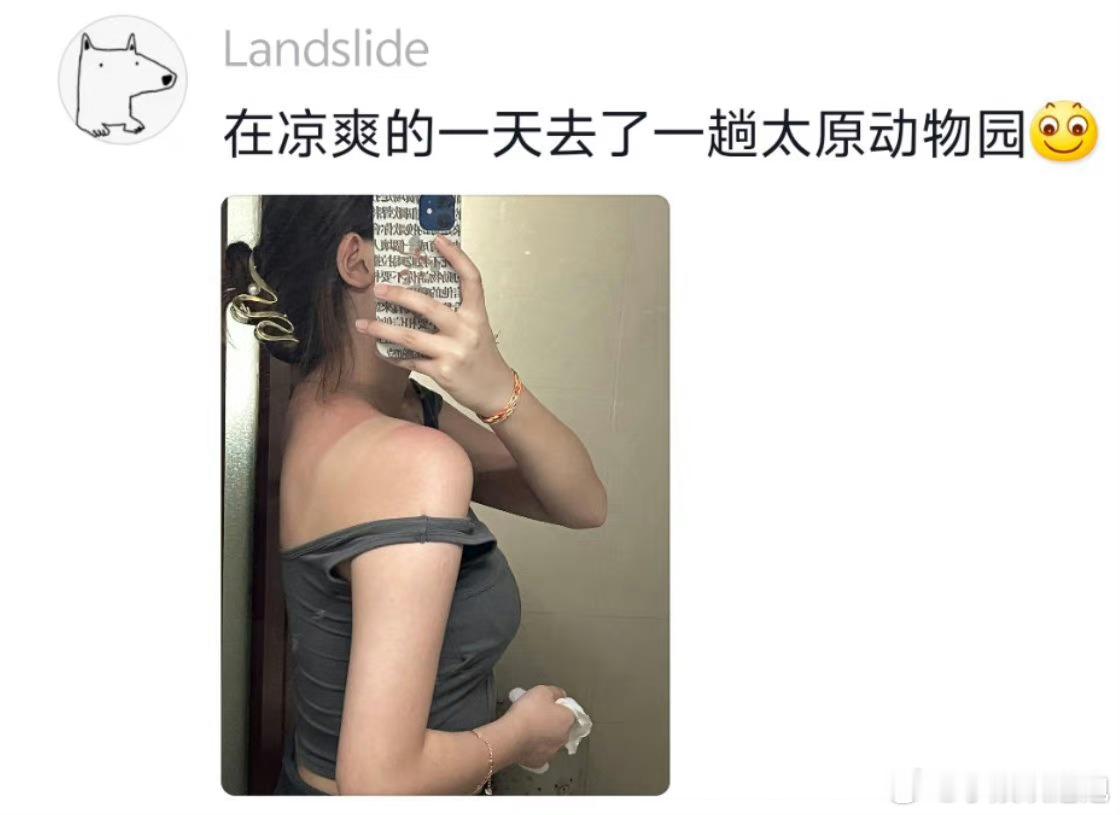 #这个夏天晒黑的不止有我#咱们就是说，夏天真的是超级容易变黑，姐妹们要想美美的，