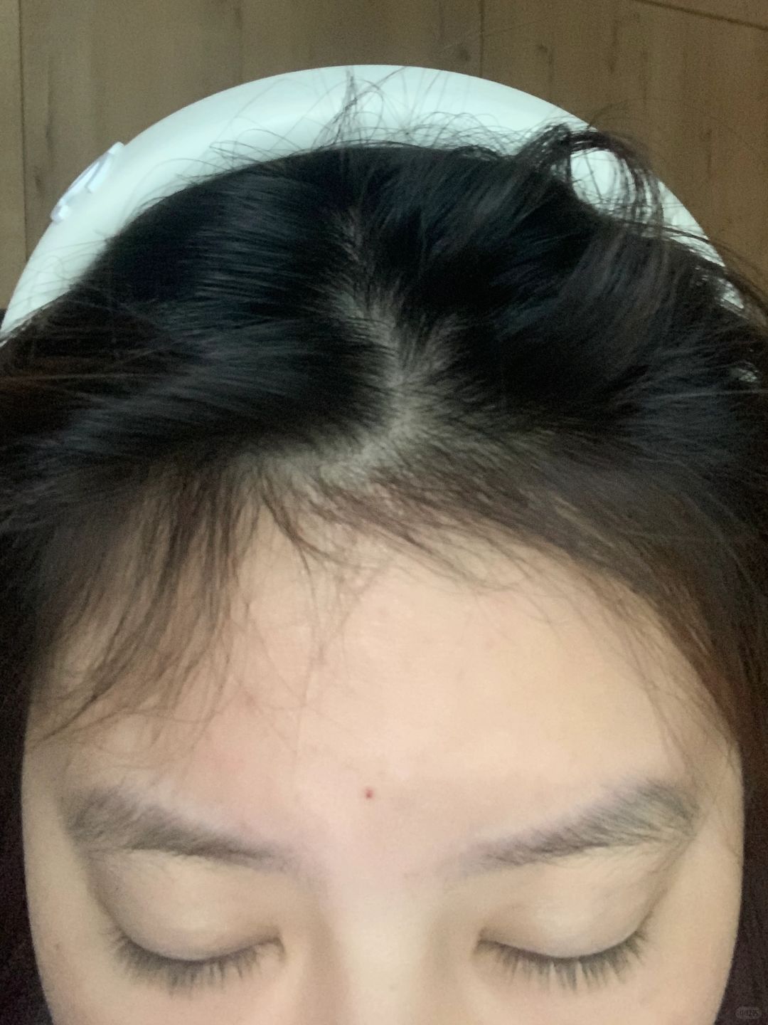 卧槽好牛！米诺地尔没做到的它做到了…