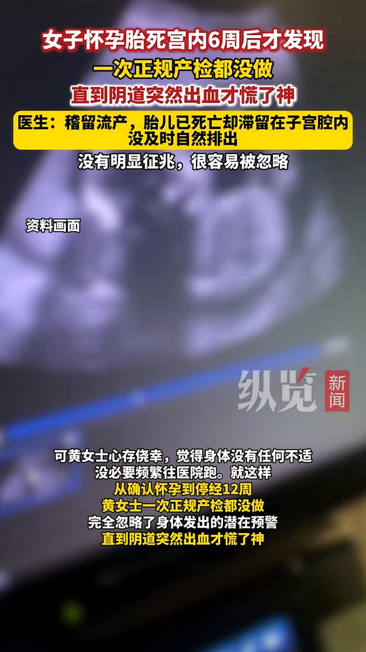 一位满怀期待迎接新生命的孕妈，竟然在胎死宫内整整6周后才后知后觉，这位女士和丈夫