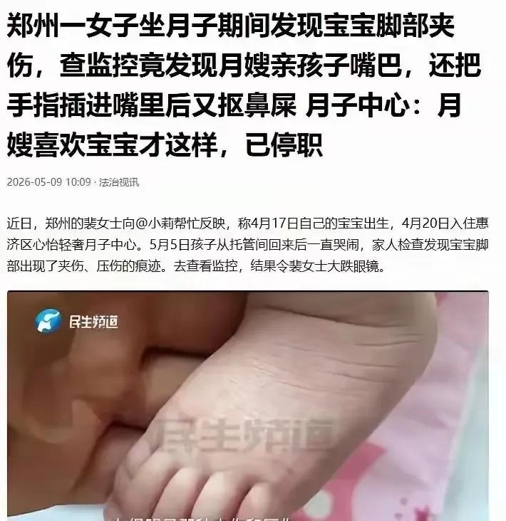 月嫂就是这么喜欢孩子的。
郑州一家高端月子中心。
孩子的脚踝被夹伤，父母查看监控