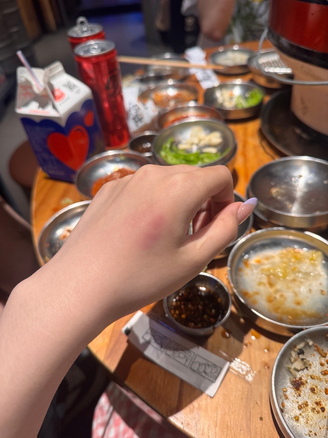 我跳那个虾米摇 锤手的动作跳了太多遍 锤成这样子 ​​​