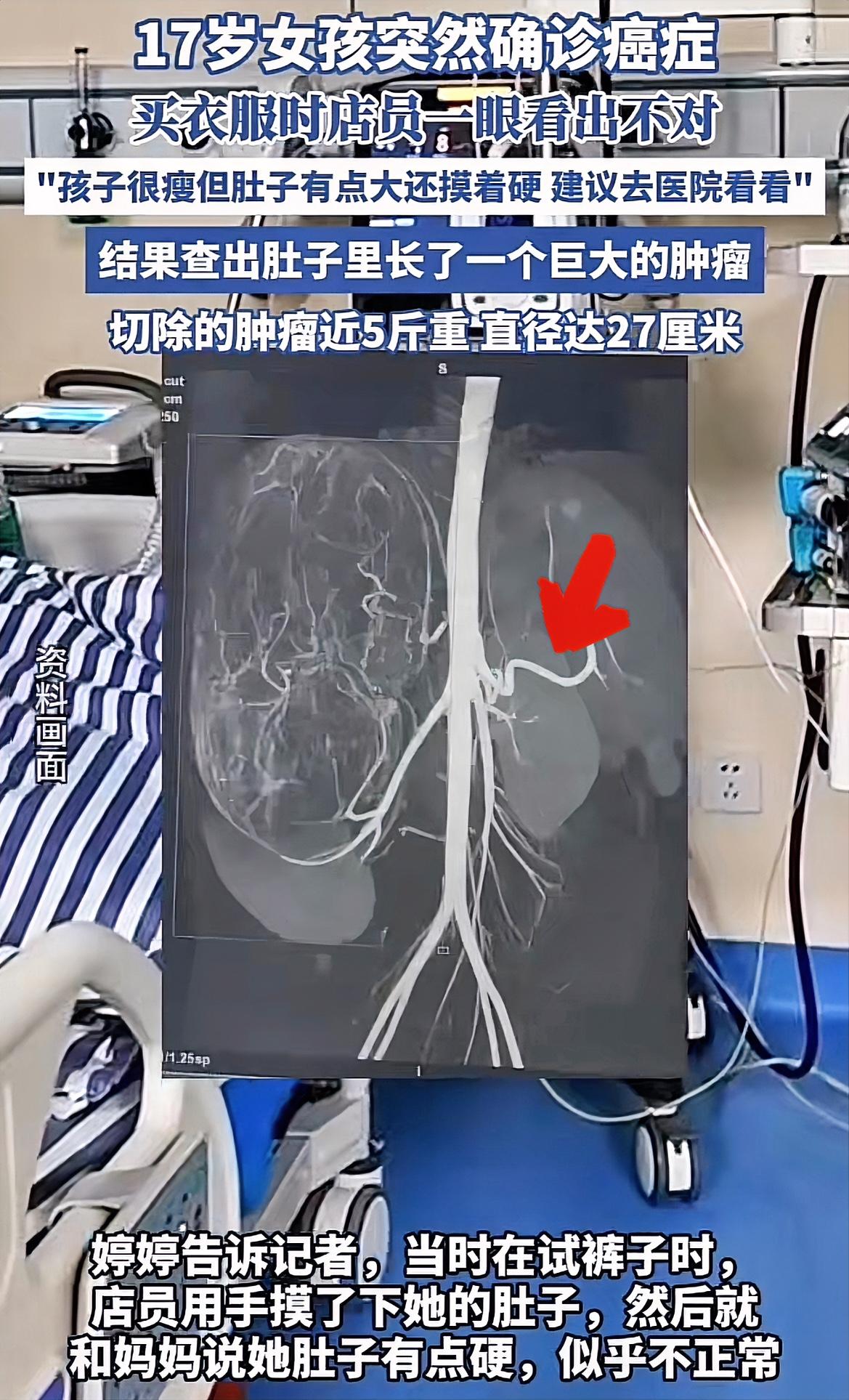 幸亏发现了！广东17岁女孩，跟着妈妈逛街买裤子，试衣时肚子异常凸起，细心的老板娘