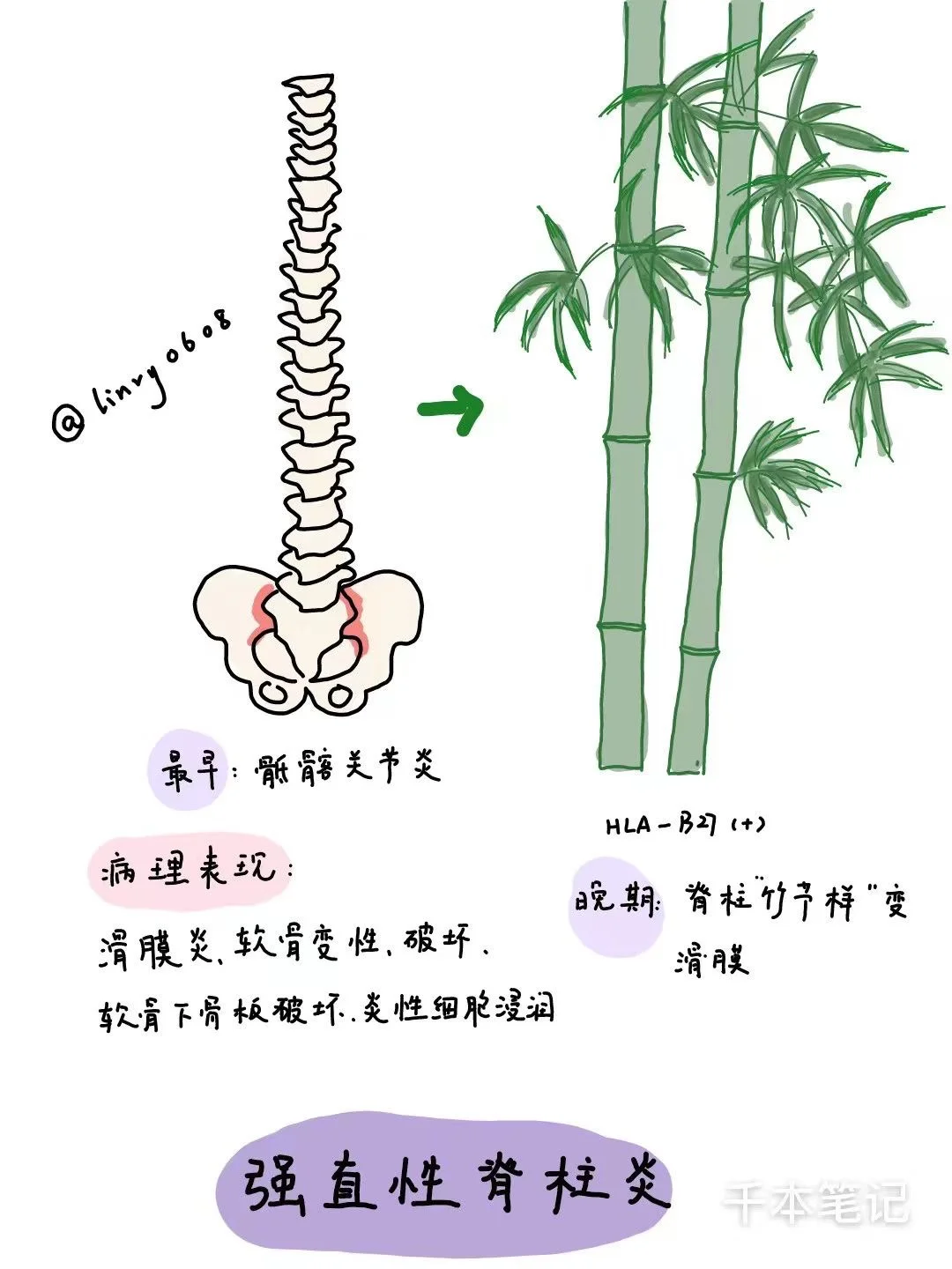 医学生绘本🎨第100弹【强直性脊柱炎】