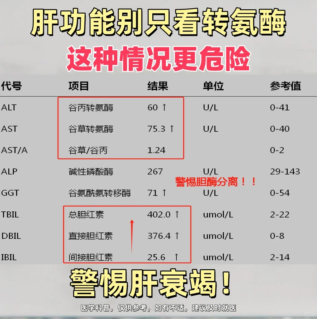 肝功能别只看转氨酶，这种情况更危险，警惕肝衰竭 这是一位山东东营患者的...