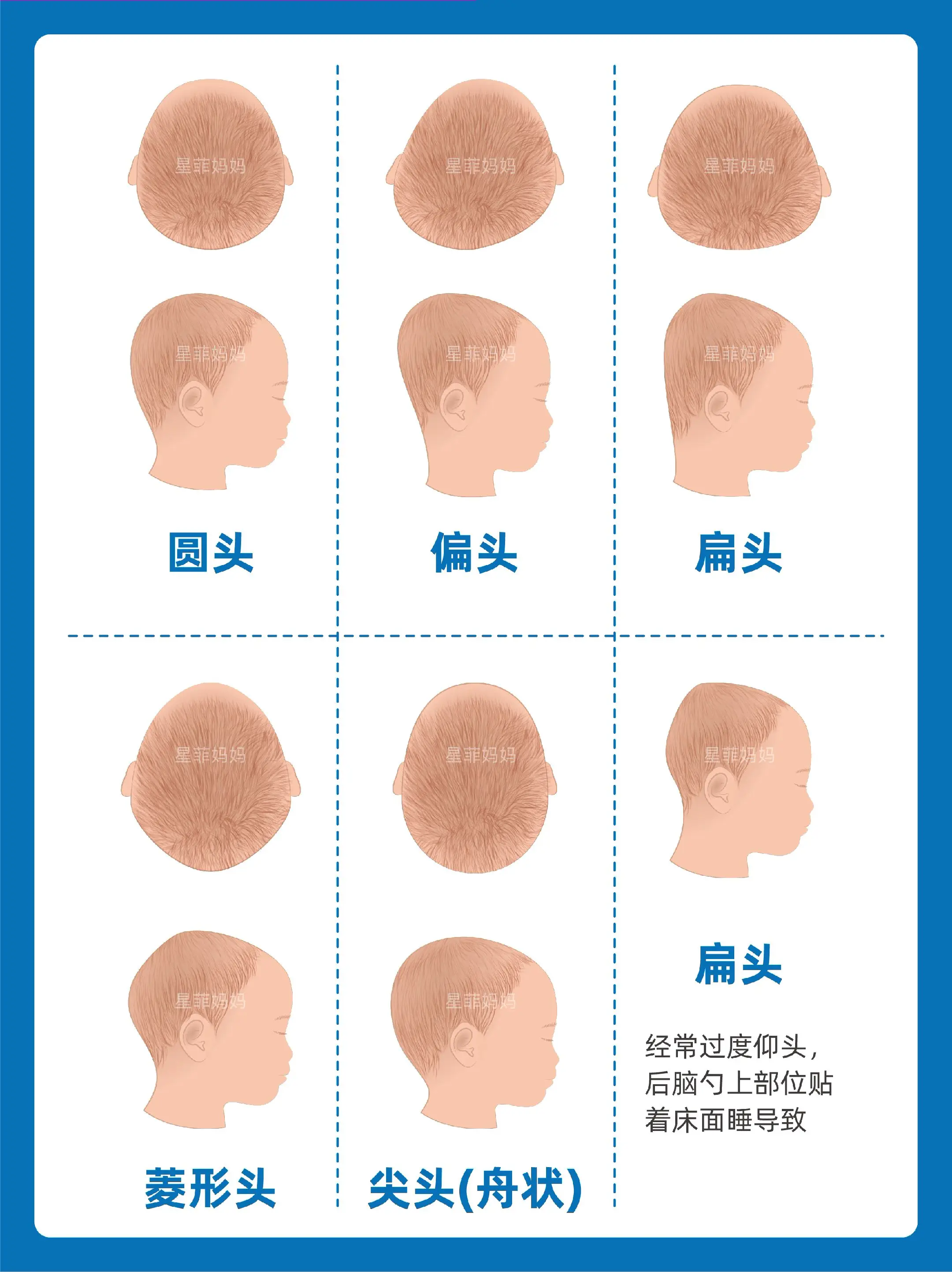 宝宝头型|新生儿如何睡圆头✅方法简单清晰。
