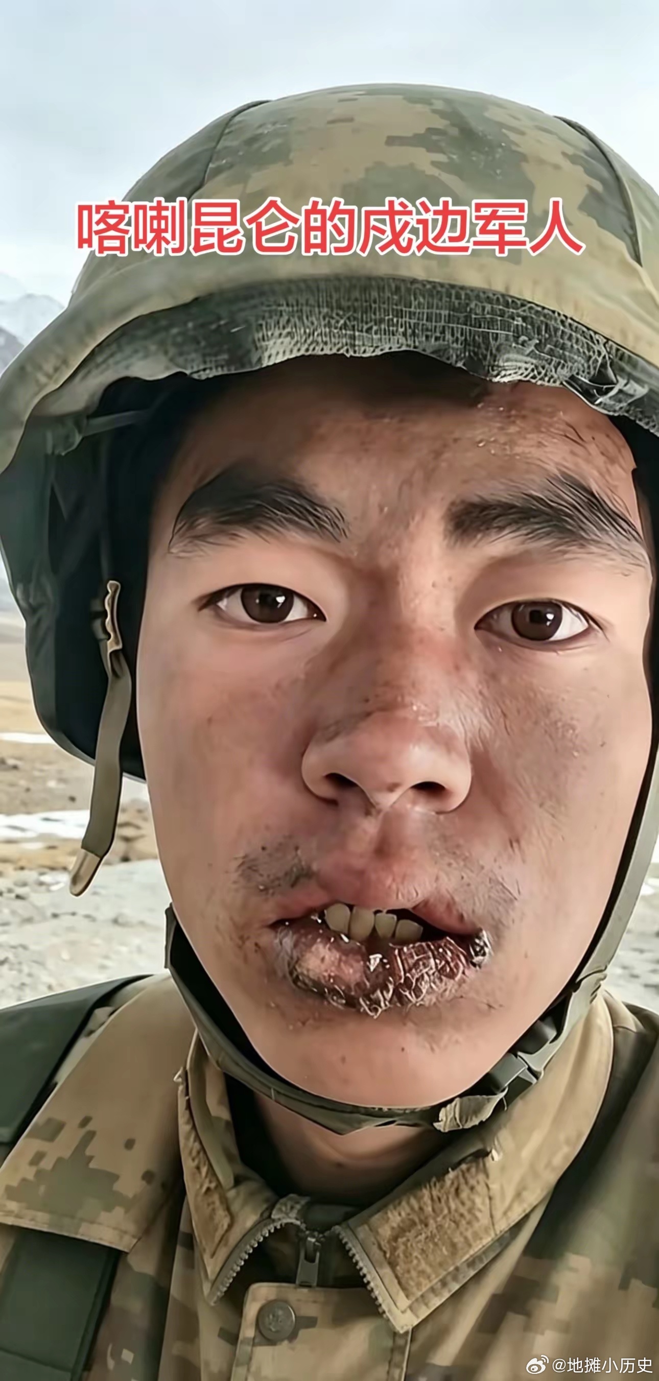 干裂的嘴唇，是属于戍边战士独有的勋章我们安稳生活的背后，是无数边防军人默默坚守。