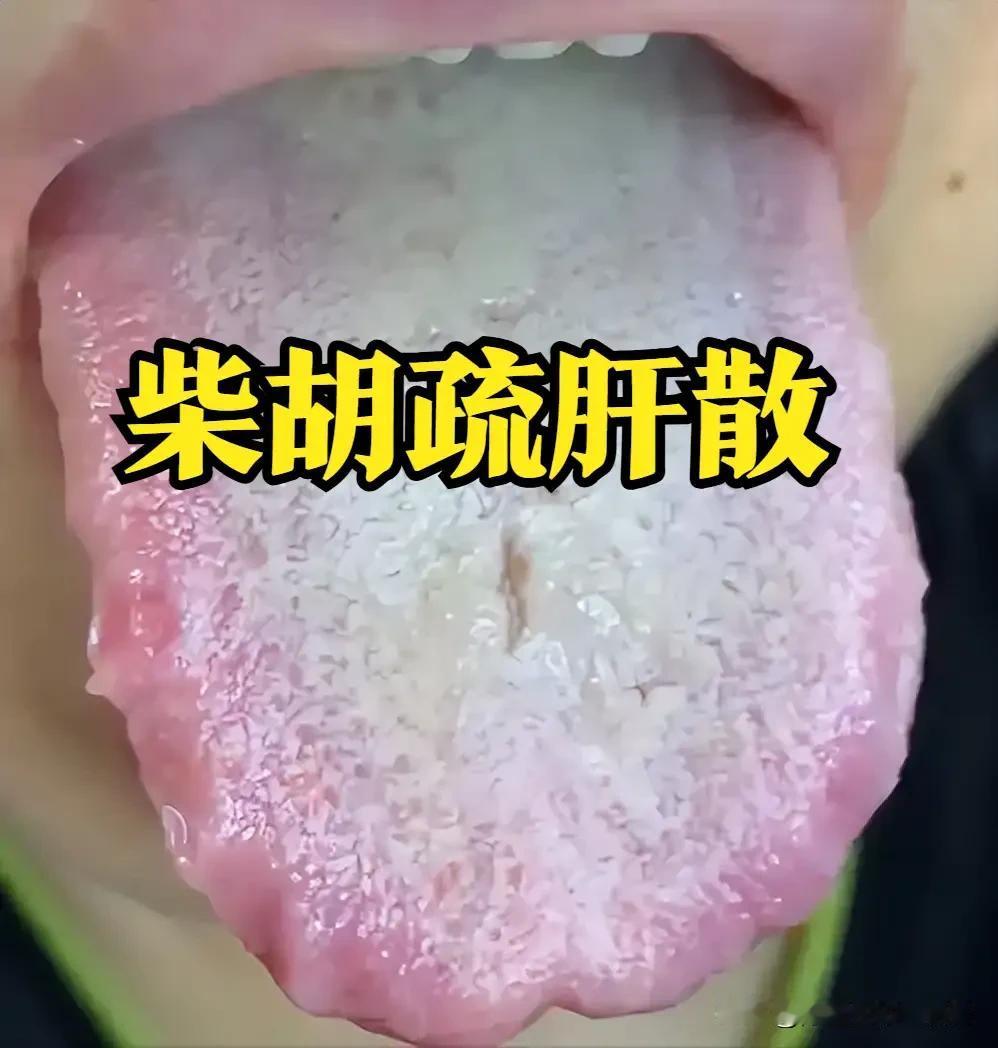 柴胡疏肝散：疏肝解郁第一方，专解肝气郁结的“郁堵”烦恼
 
大家好，我是陈大夫！