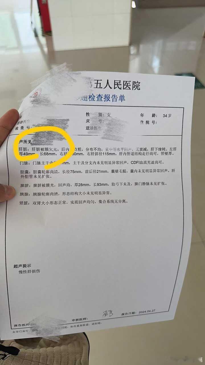 #乙肝[超话]#有乙肝，脂肪肝，都有肝纤维化，这个没法避免，只有好好抗病毒，减肥