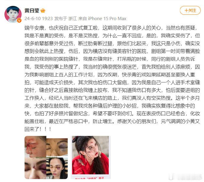 黄日莹晒脸部伤口照片回应，否认买热搜炒作。 6月10日，黄日莹发文回应近日被传拍
