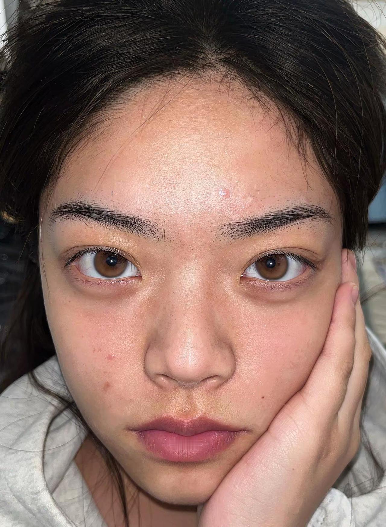 瑕疵让我变得鲜活