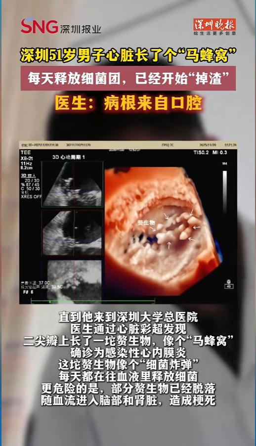“万万没想到！”5月12日报道，广东深圳，一男子反复低烧，胃口也不好，人都饿瘦了