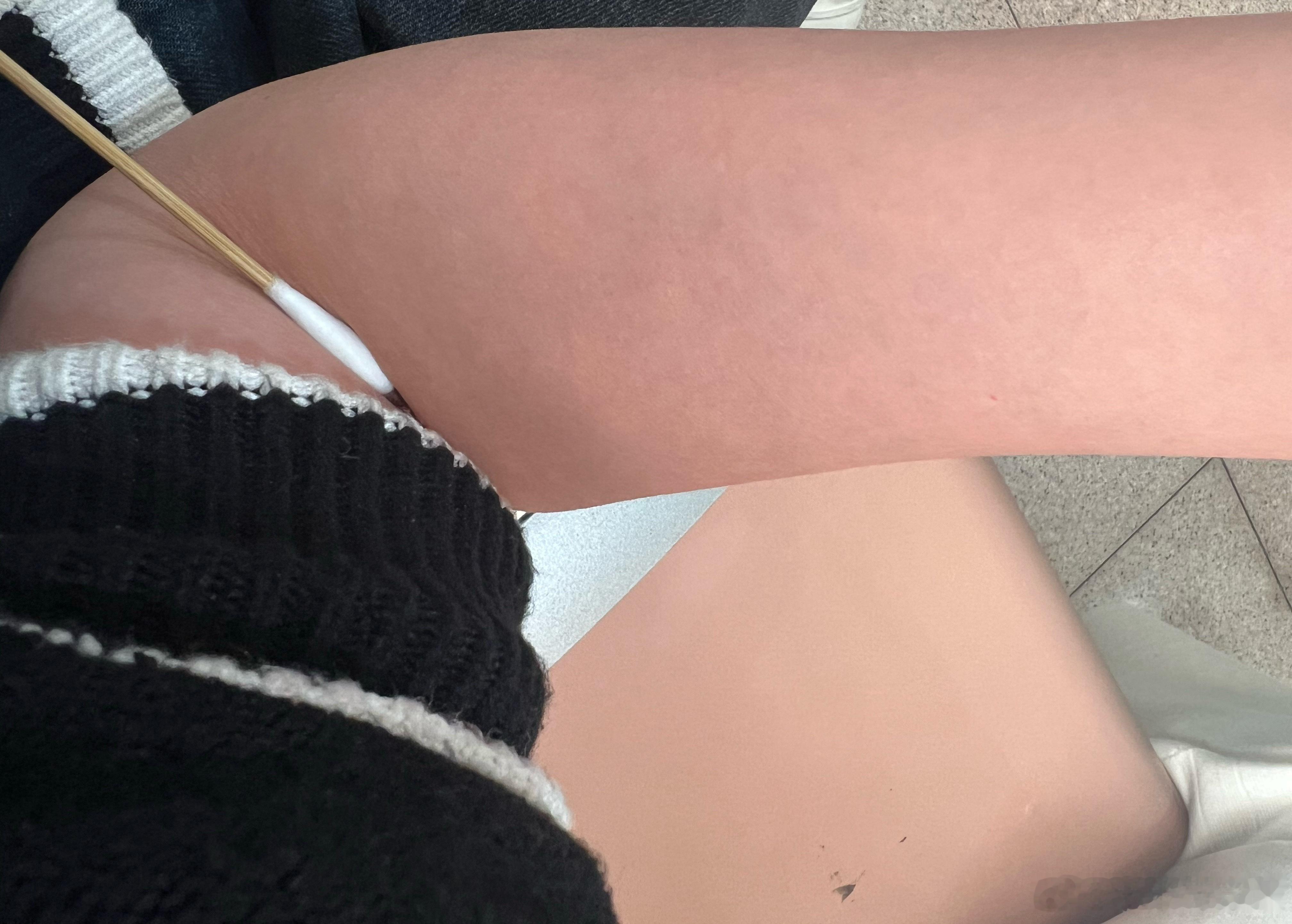 看着那绿色针头给我抽血～真的每一次都发怵现在能理解病人的害怕了米妈日常分享