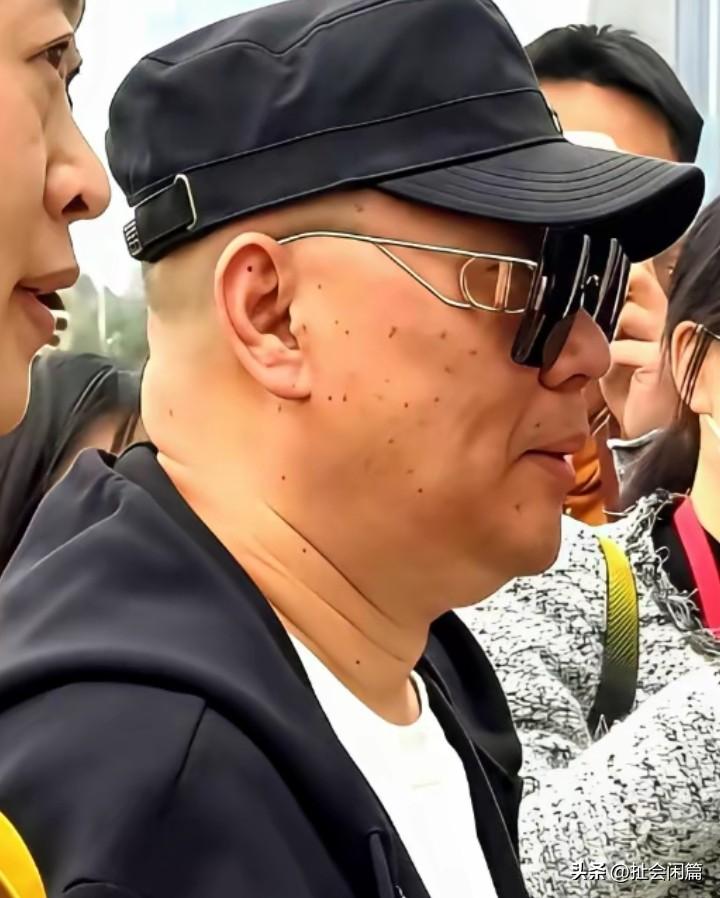 郭老板的脸上咋这么多痦子？
还说烧饼脸上好多痦子跟撒了芝麻一样，他这也跟烧饼差不