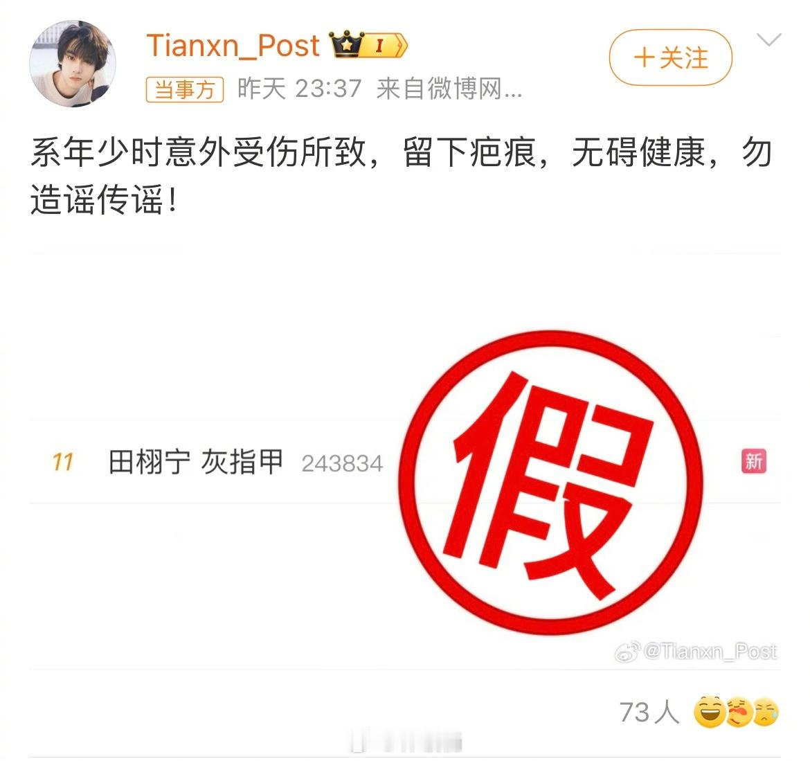 田栩宁对接回应是年少意外受伤导致，留下了疤痕！！田栩宁 灰指甲 ​​​