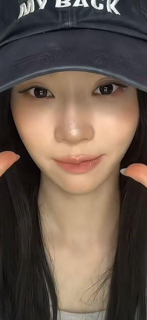 金冬天鼻子怎么了 