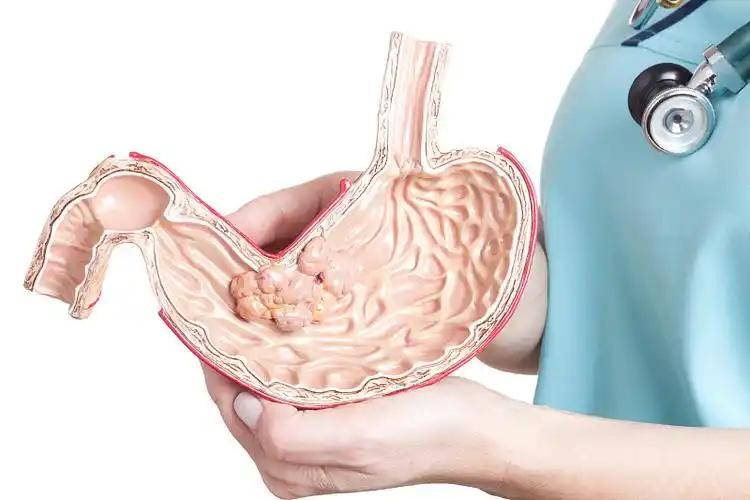 《哈佛大学分析100名胃癌患者，惊讶发现：患胃的人，有7大共性》
这年头，胃病不