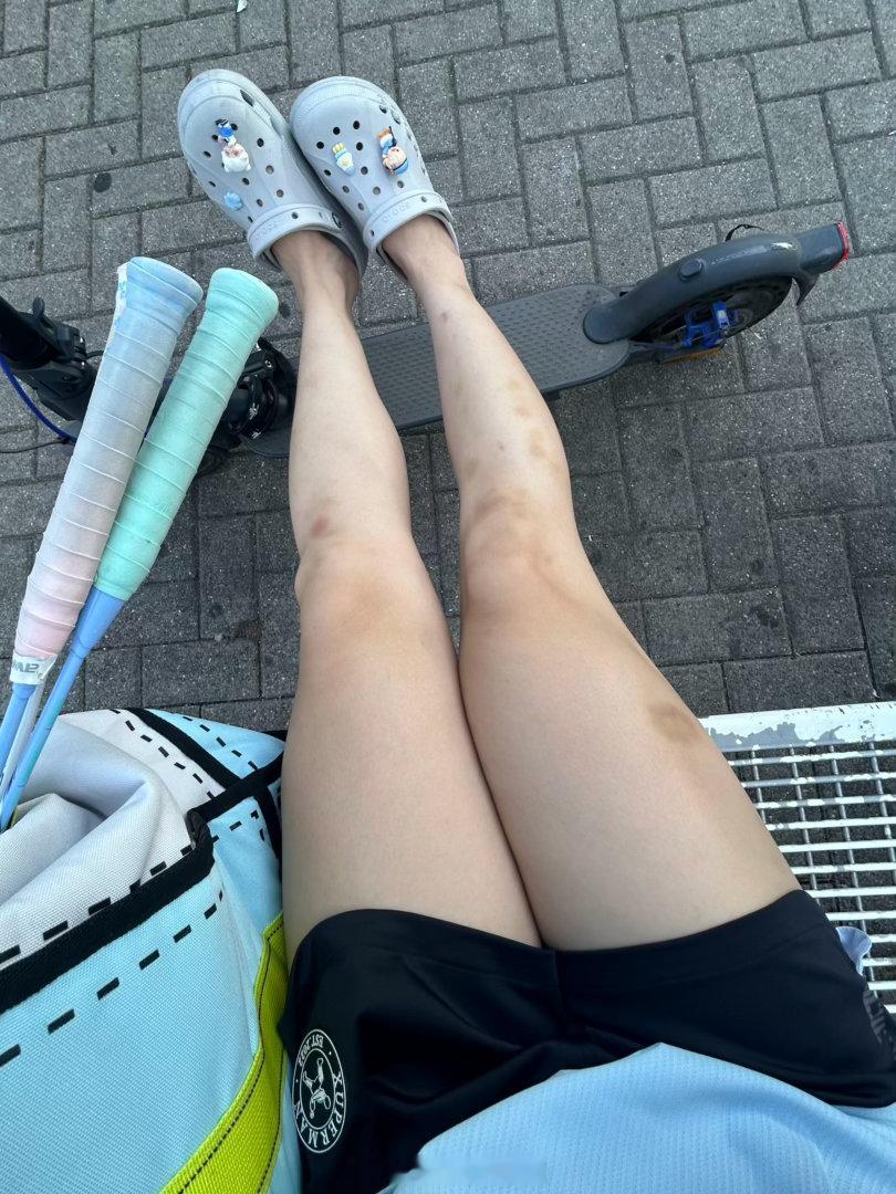 打了个A救了几个球腿就这样？？？后知后觉明白搭档34℃穿长裤的意味