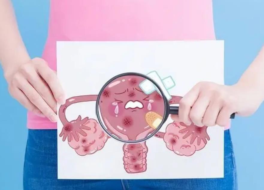 #健康真探社#【女性患“巨阴症”，就不能生育了吗？】巨阴症实际上是先天性肾上腺素