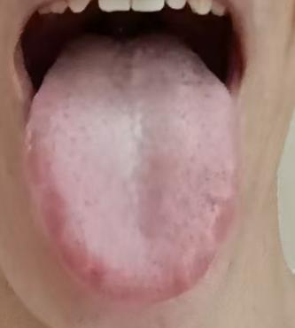 宗筋不振、精关失固辨证，心脾肾三脏同调治本思路详解






前段时间有位长期