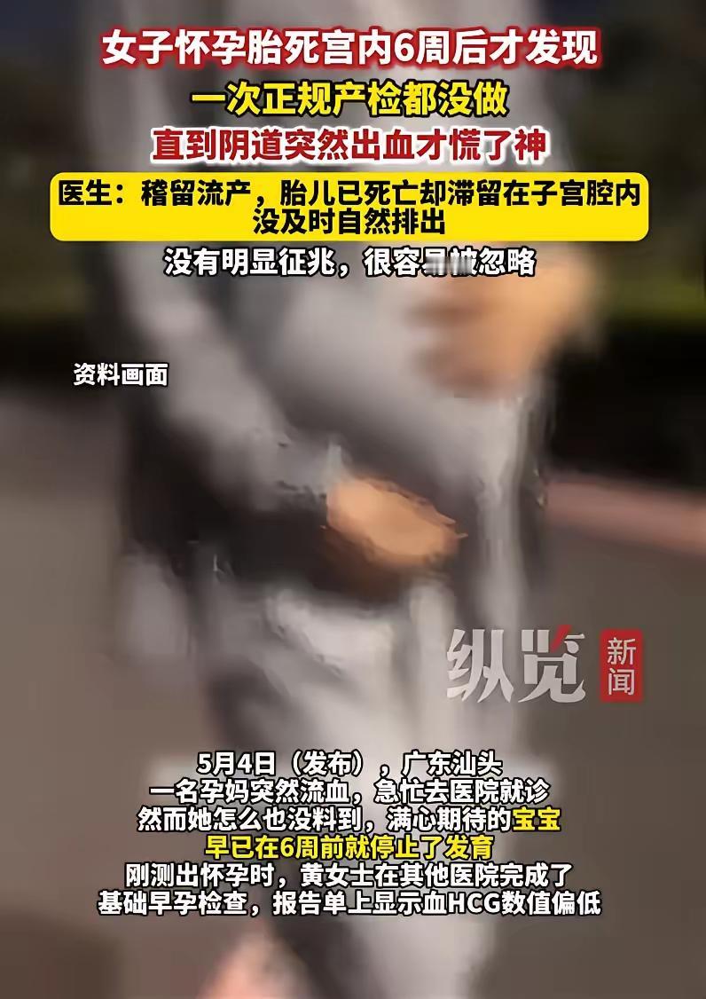 5月5日报道，广东汕头一名孕妈突然出现下体流血的异常情况，急忙前往医院就诊检查。