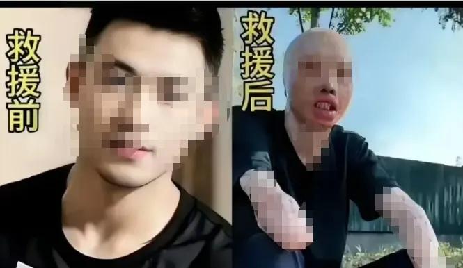 消防队员：出发时英俊帅气，归来时伤痕累累；为了人民安全，牺牲自己的身体和生命。