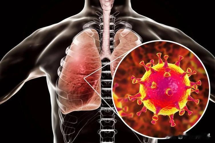 甲流致死率上升？医生紧急提醒：牢记“三不吃两坚持”，这5类人尤其要警惕！
 
最