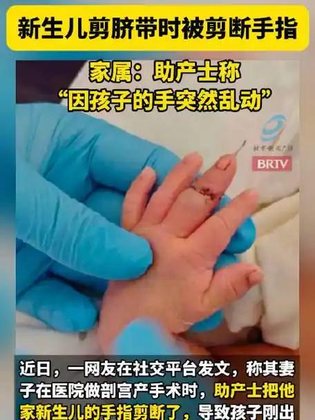 太离谱！剪脐带竟剪断新生儿手指！官方通报来了，涉事人员处理结果出人意料
 （个人