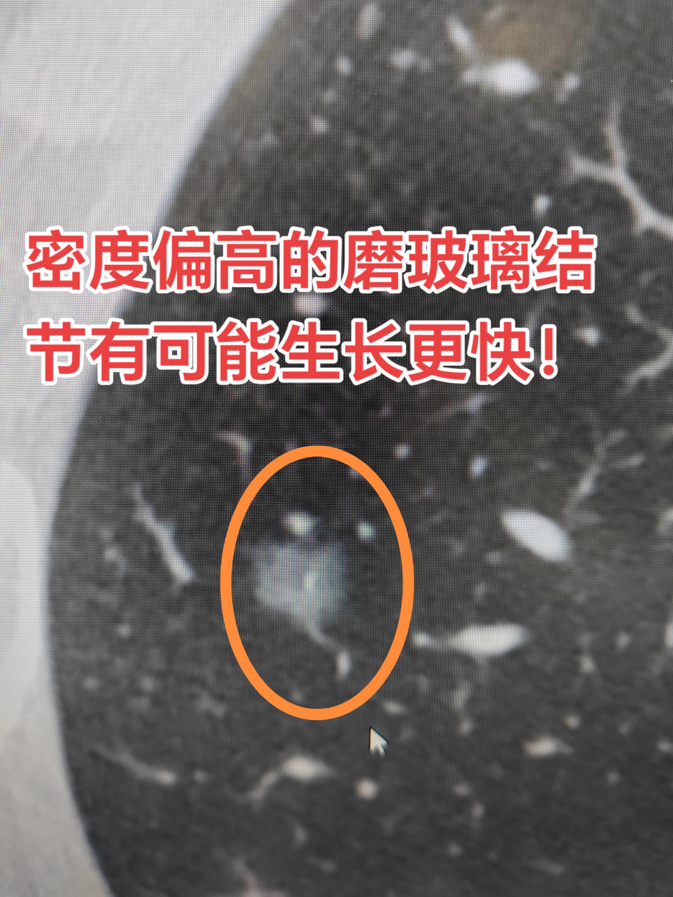 密度偏高的磨玻璃结节有可能生长更快！磨玻璃结节即使是恶性一般也呈惰性增...