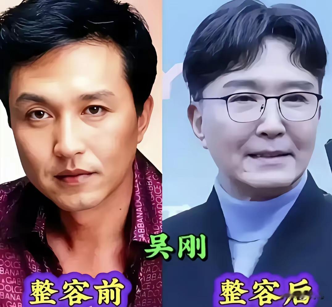 不能以整容论英雄吧！许多明星们选择整容，我觉得有时候也是工作需要，尤其是现在社会