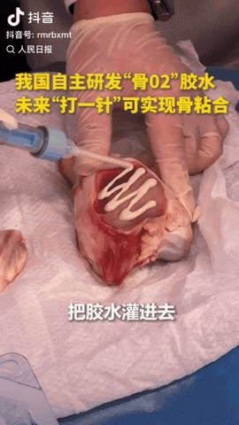 神奇的“骨02”胶水
我国自主研发的“骨02”胶水很神奇，未来骨折只需打一针，就