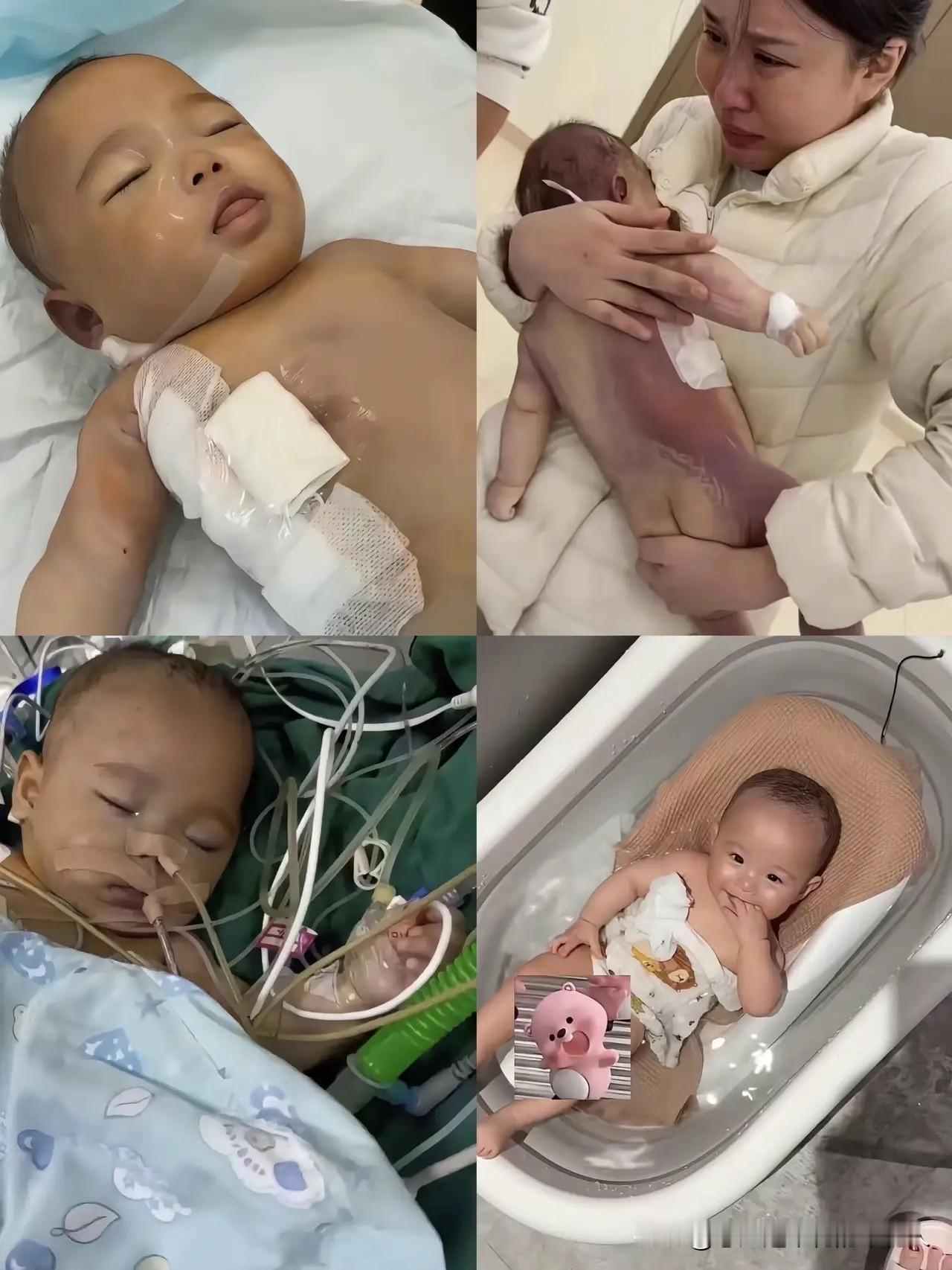 央视终于出手介入了！浙江那个五个月大的宝宝，做微创手术最后却不幸离世，真的太让人