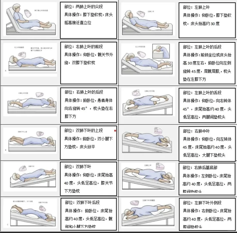 体位引流