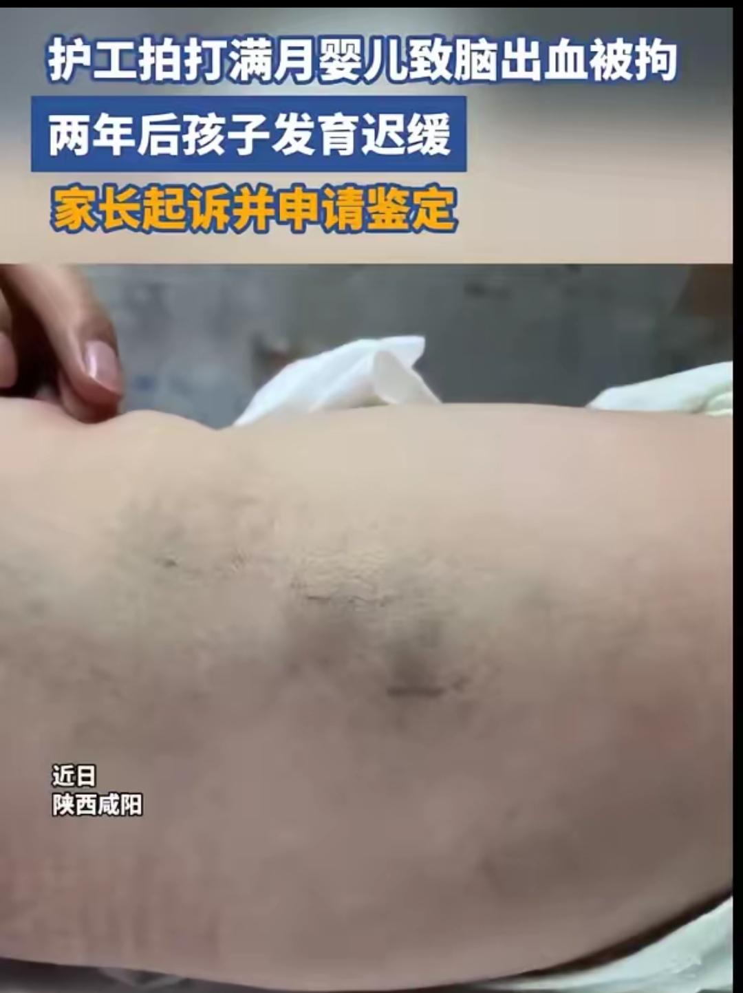 陕西咸阳，一名才刚满31天的小男婴，本该在家人的怀里温暖地睡觉喝奶。却被一个护工