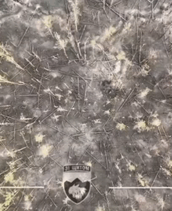 俄乌战场的医学奇迹。担架队抬着1名俄军伤员被乌军无人机袭击。之前还动弹不得的伤员