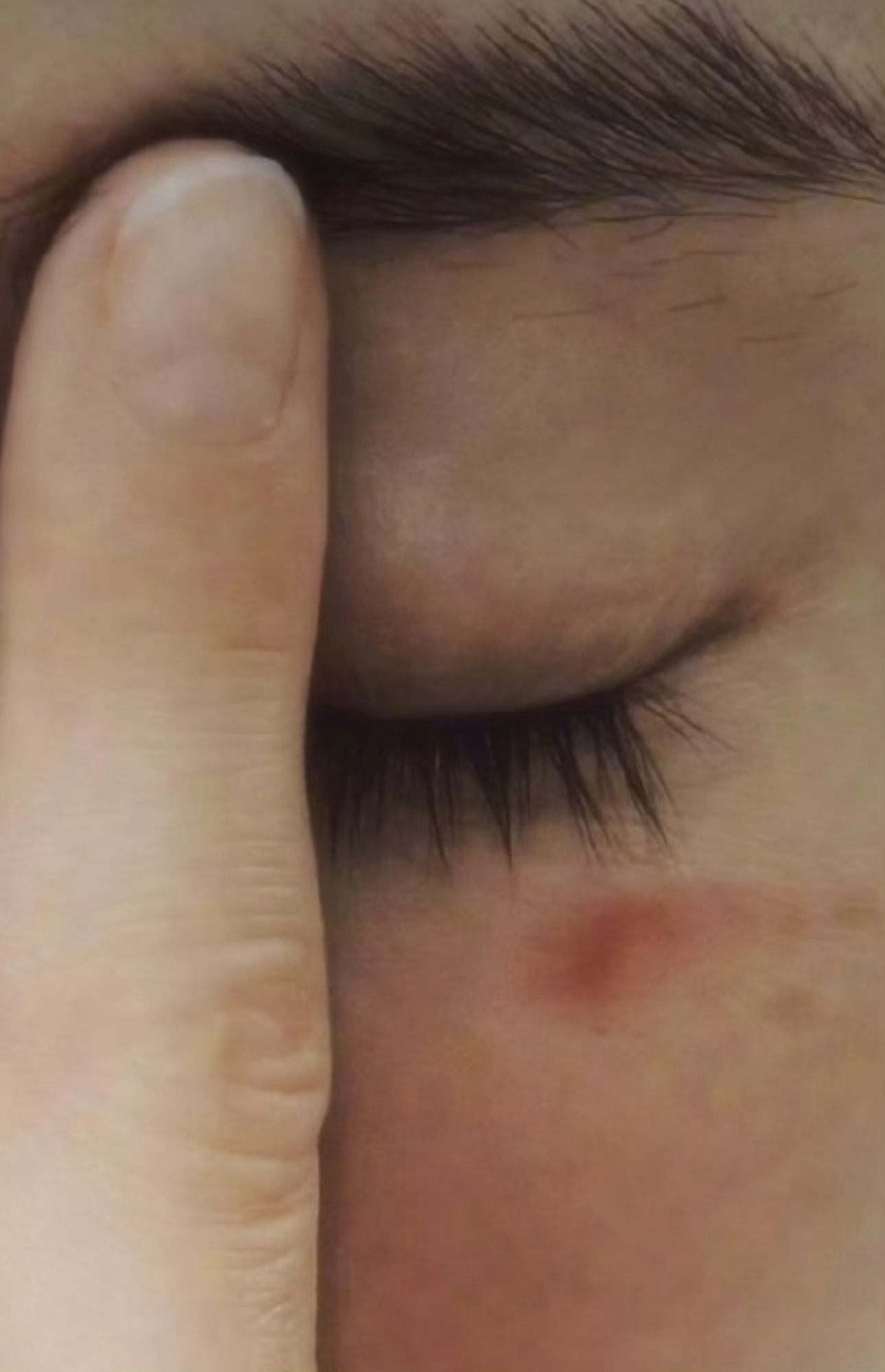 姐就和马蜂撒个娇 就这么轻轻松松的爆啦～杨幂脸被蒸汽眼罩烫伤了