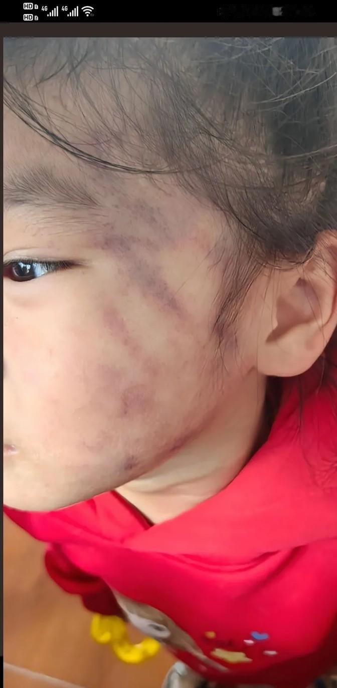 孙女被奶奶扇了好几巴掌，妈妈看到气坏了，质问奶奶：你怎么能打自己的外孙女呢？奶奶