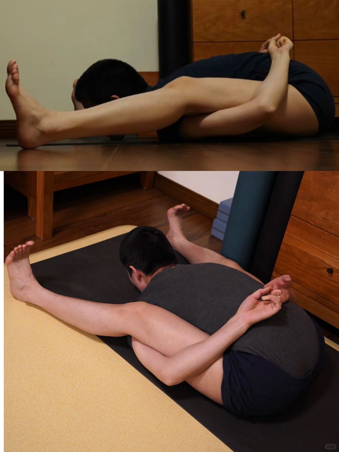 看图辨别，什么是骶髂关节紧张？