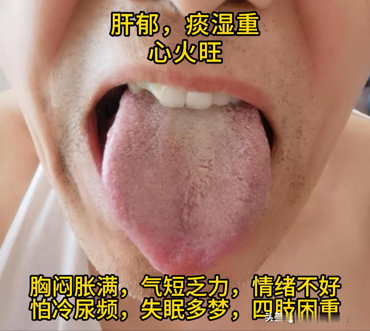 今天有空，可以帮大家看看舌象。
有需要的，尽管把你的舌象照片发过来吧！越早发，我