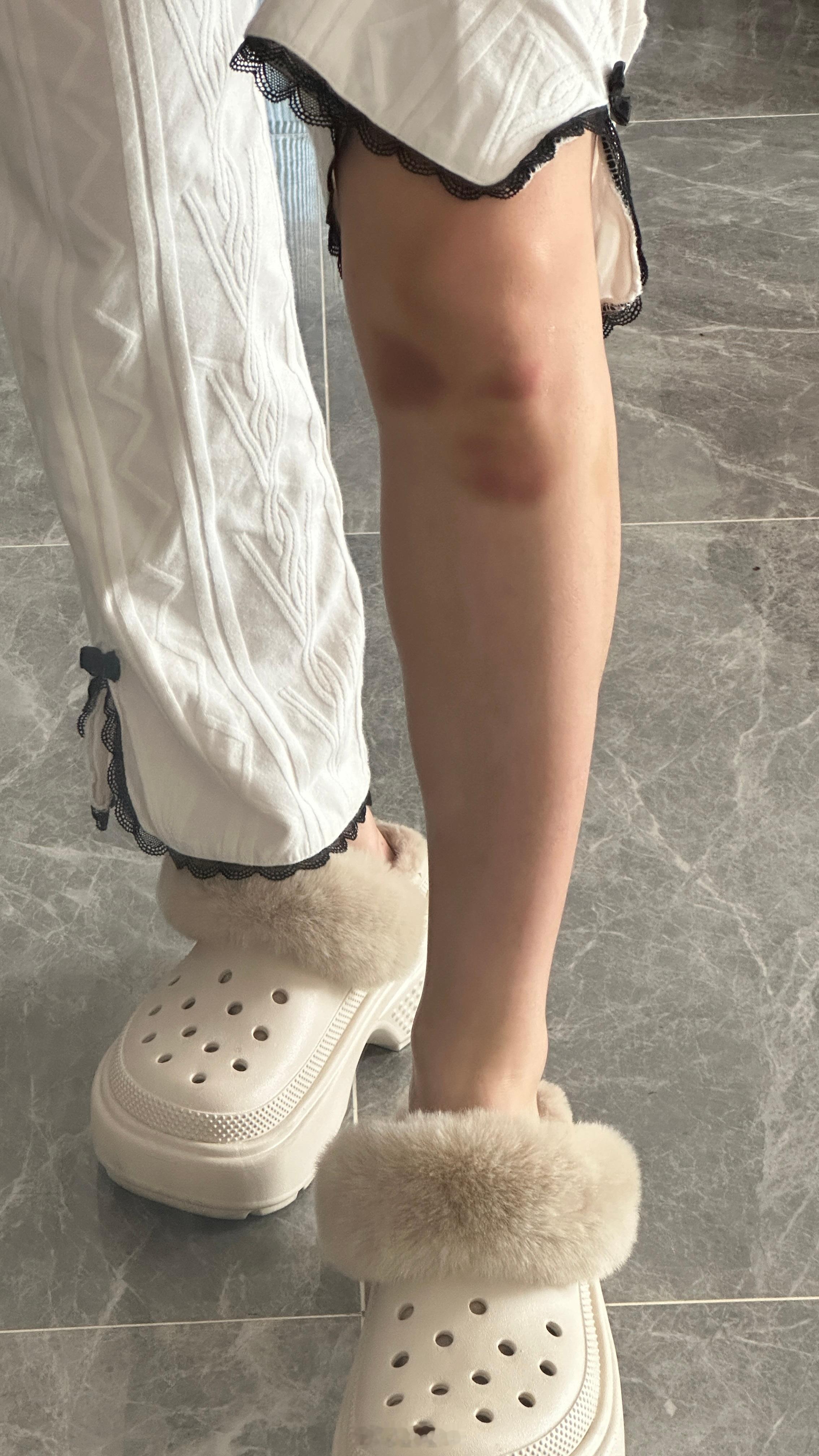 犹豫了下还是踩着高跟鞋出门了[舔屏]每天跳的浑身铁青，带护膝也没用[爱你]但内啡