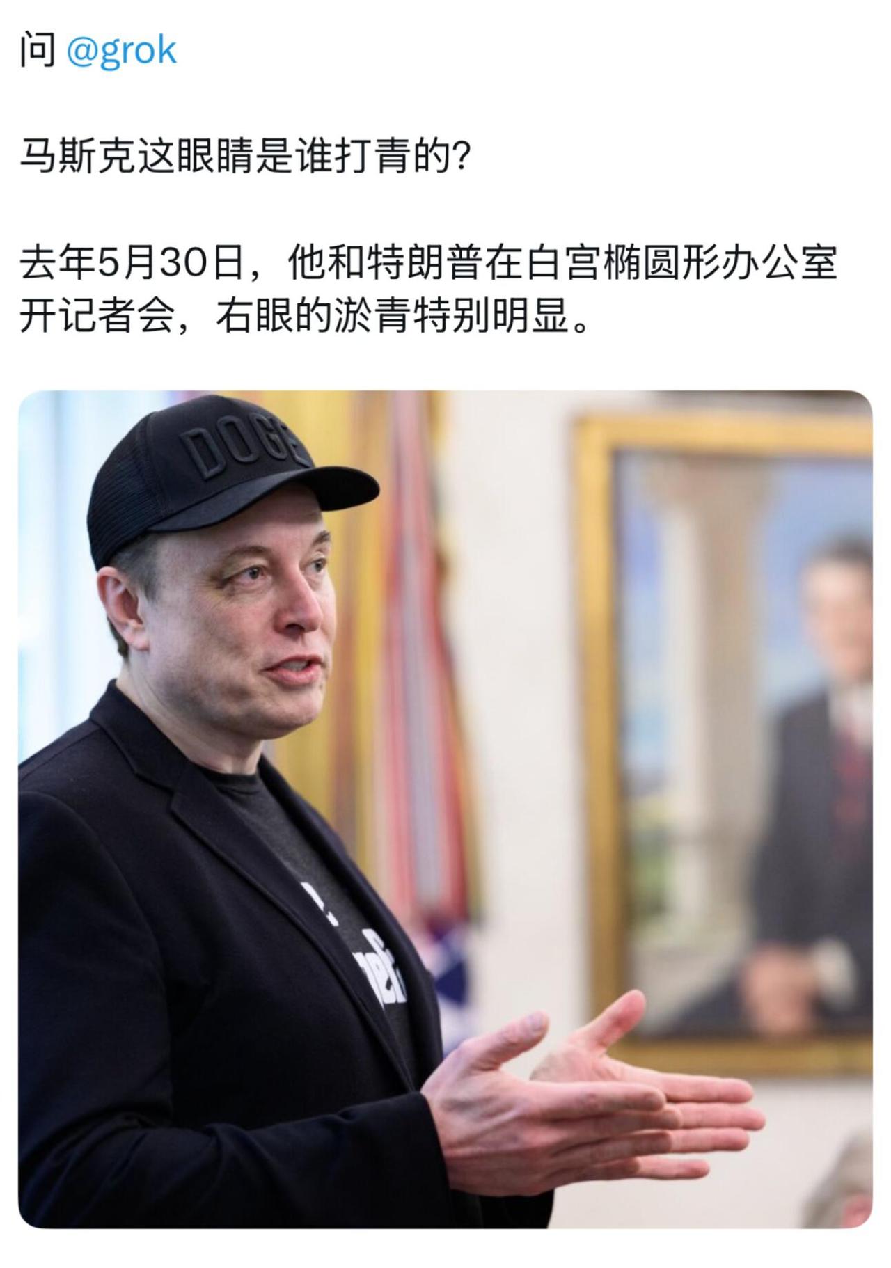 马斯克被X打了🤣你得多BT，才会叫儿子X打❓||Globall[话题] 马斯克