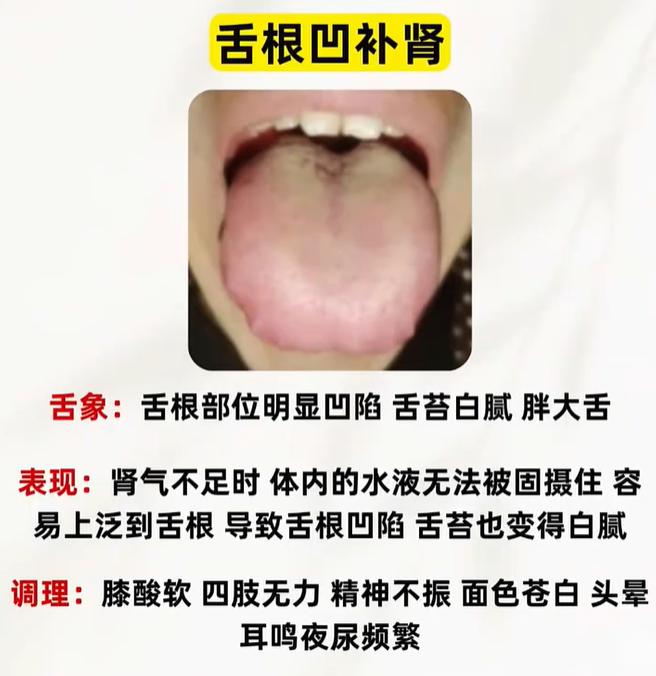 中医舌诊科普：舌头不同位置凹陷，对应心脾肾亏虚详解