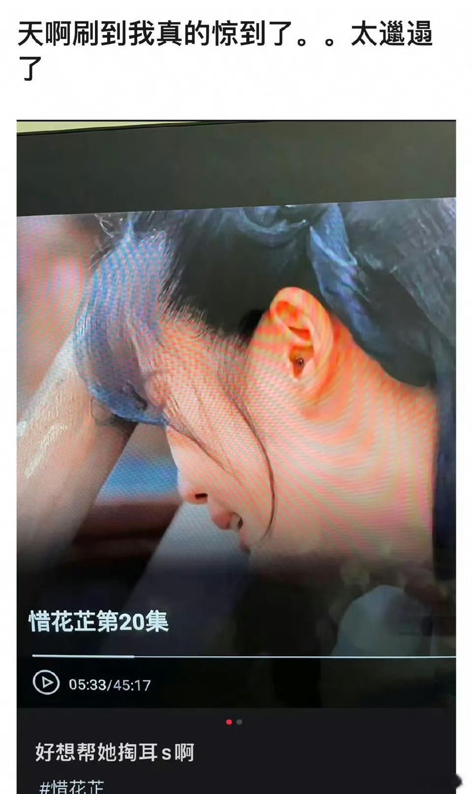 卢昱晓被吐槽有耳屎🙉 ​​​