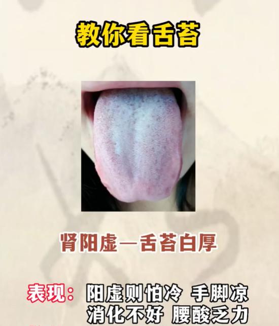 4 种舌象，一眼看懂气血与肾虚问题
