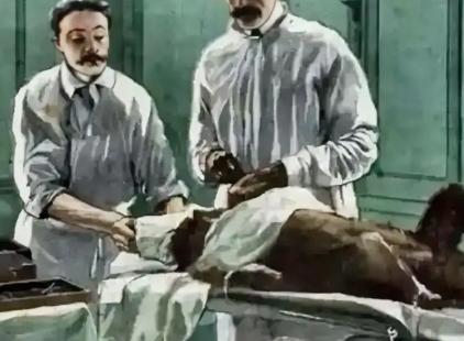 1920年，一俄国医生突发奇想，将猴睾丸移植到74岁老人体内，术后，没想到这位老