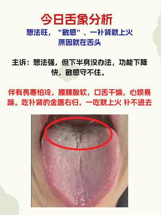 今日舌象分析
