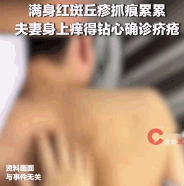 一名男子在朋友家留宿数日后，身上突发瘙痒，肚子、大腿陆续长出红疹。他误以为是南方