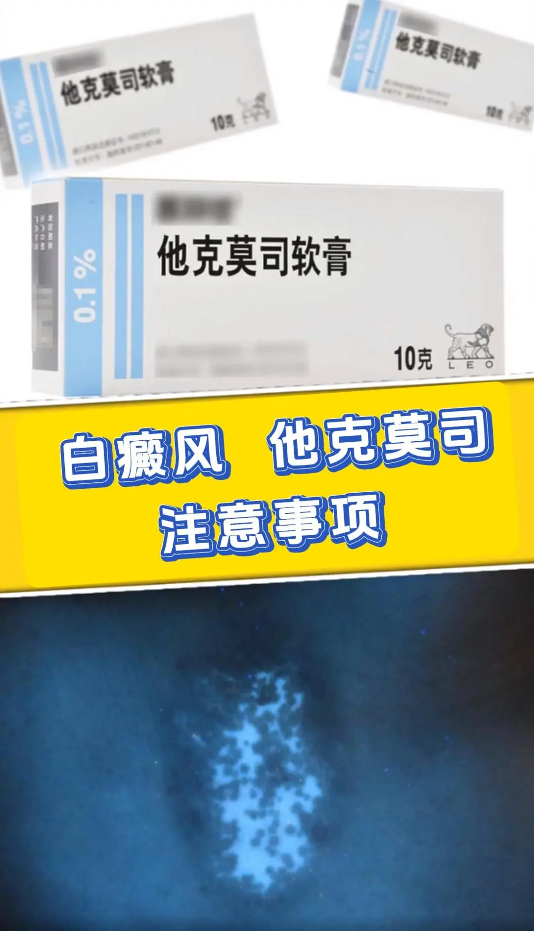 在使用他克莫司治疗白癜风时，以下是一些重要的注意事项： 1、清洁皮肤...